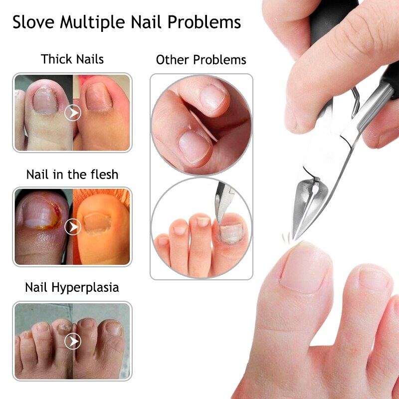 Nail Cuticle Scissors Fingernail&amp;Toenail Nail Clippers Toenails Nippers Dead Skin Remover Manicure Tool Pedicure Trimming E0002A