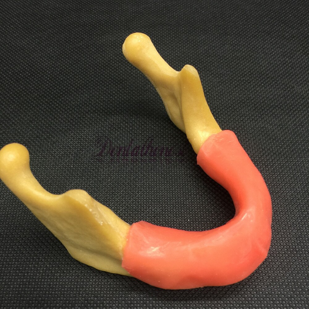 Dental lower jaw implant model simulation of human vicedeal