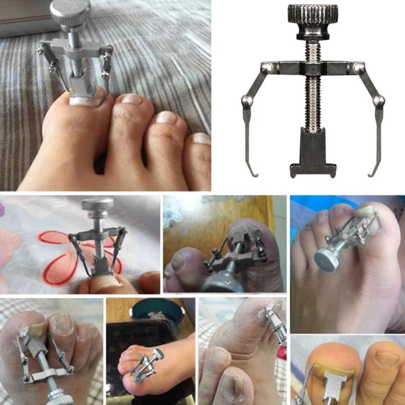 Ingrown ToNail Recover Correction Tool Pedicure Toenail Fixer Foot Nail Care LP