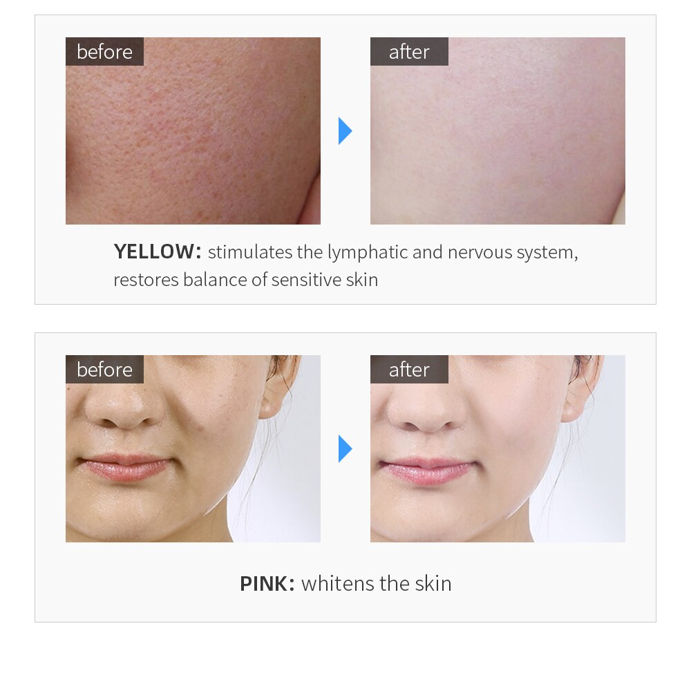 LED Mesotherapy Electric Lighten Spots Reduce Fine Lines Wrinkles Improve Skin Tone Balance Lifting Whitening Skin Beauty Device