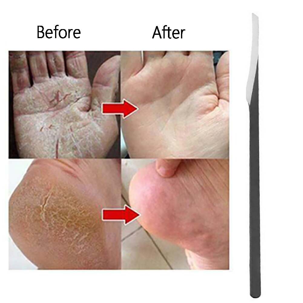 maison pied grattoir Portable callosités rabotage acier tungstène soins tondeuse pédicure outil talon peau fichier orteil couture