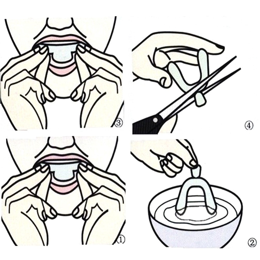 Novo 4 pçs silicone noite protetor de boca para os dentes clenching moagem dental mordida sleep aid branqueamento dentes boca bandeja