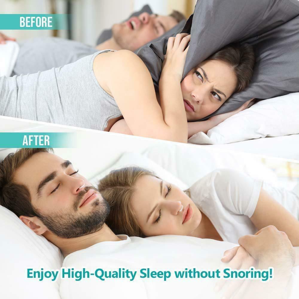 Siliconen Neus Clip Magnetische Anti Snore Stopper Snurken Stille Slaap Steun Apparaat Guard Night Anti Snurken Apparaat Gezondheidszorg