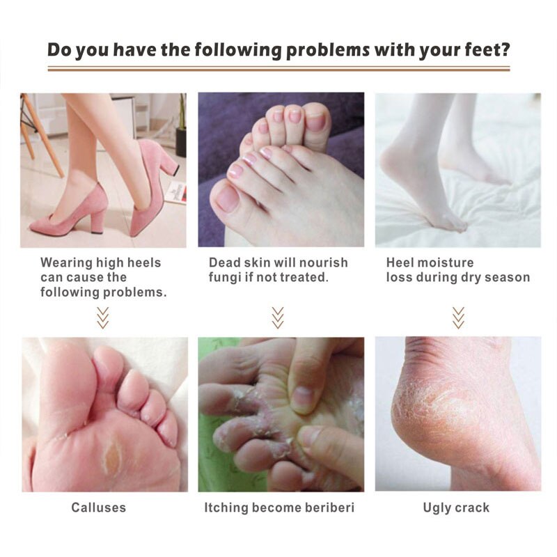 Electric Heel Callus Remover 2000MAh USB Recharging Foot File Care Tool Feet Hard Dead Skin Removal Pedicure Device