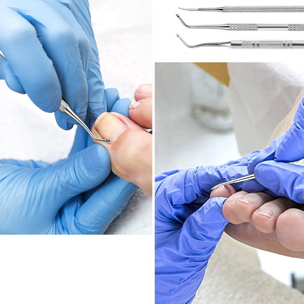 3PC Double Ended Toe Nail Care Hook Ingrown Toe Correction Lifter Foot Toenail File Cuticle Pusher Manicure Pedicure Tools set