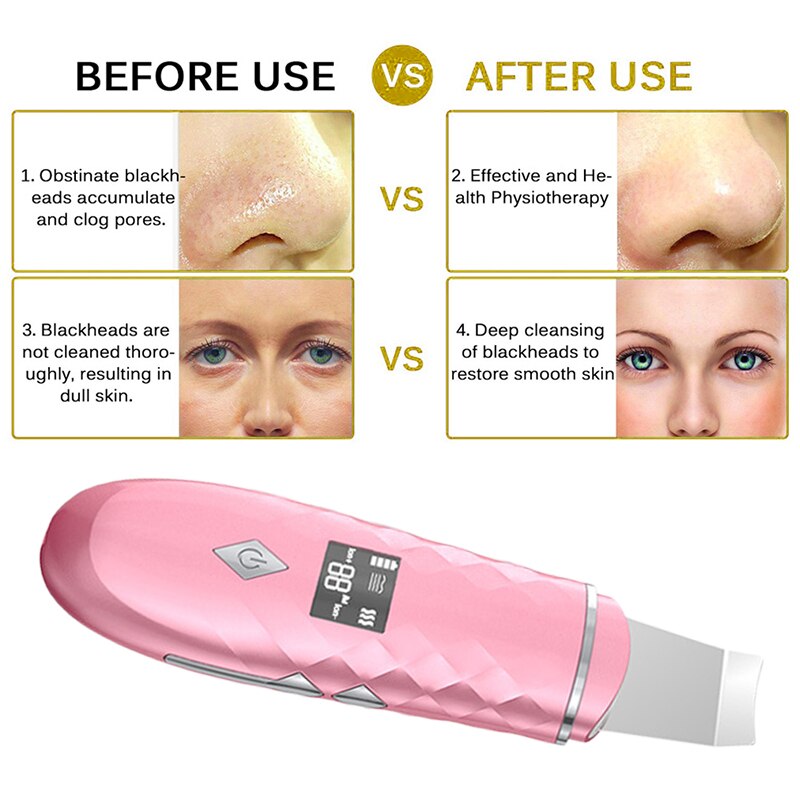 Verwarmend kompres en schepmachine, ultrasone schoonheidsbehandeling, introductie van ionen in een mee-eter poriënreinigingsinstrument