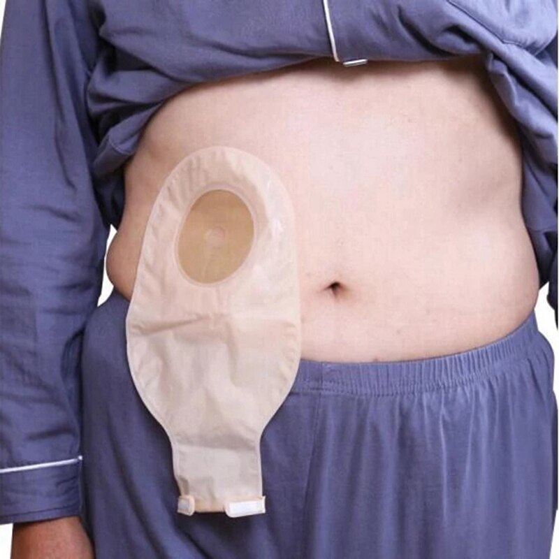 Stoma Zakken Een Stuk Lensbare Zakjes Voor Colostomy Ileostomy Stoma Care 20-60Mm Zuinig Aftapkraan Colostomyzak Zakken