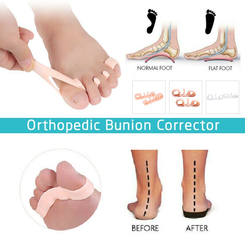 1Pair Soft Silicone Toe Separators 3/5 Holes Elastic Bunion Corrector Orthotics Toe Straighteners Relieve Foot Pain Unisex