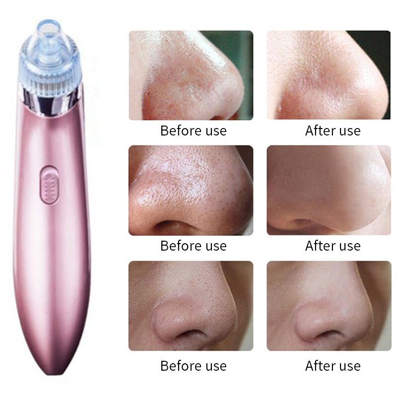 Mee-eter verwijderaar elektrische stofzuiger poriënreiniger mee-eter zuigmachine comedonen verwijderaar gezichtshuidverzorging