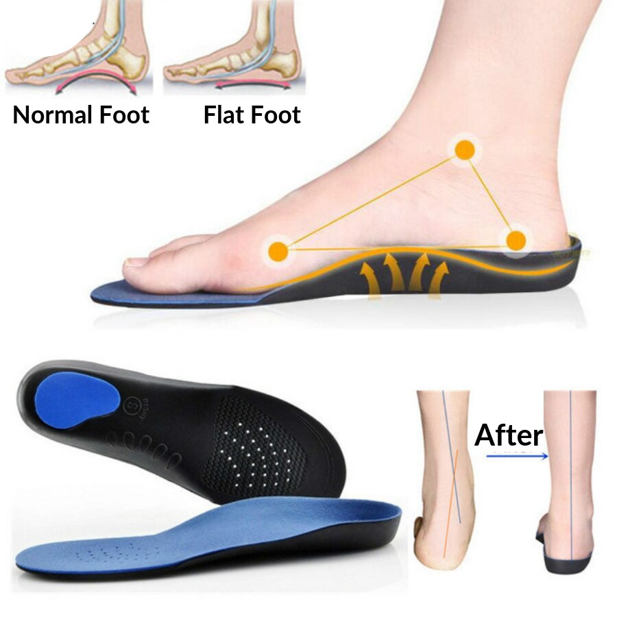 Flade fødder bue støtte indlægssåler ortopædisk højde 3cm 3d premium behagelig plys klud ortotiske indlægssåler fodpude