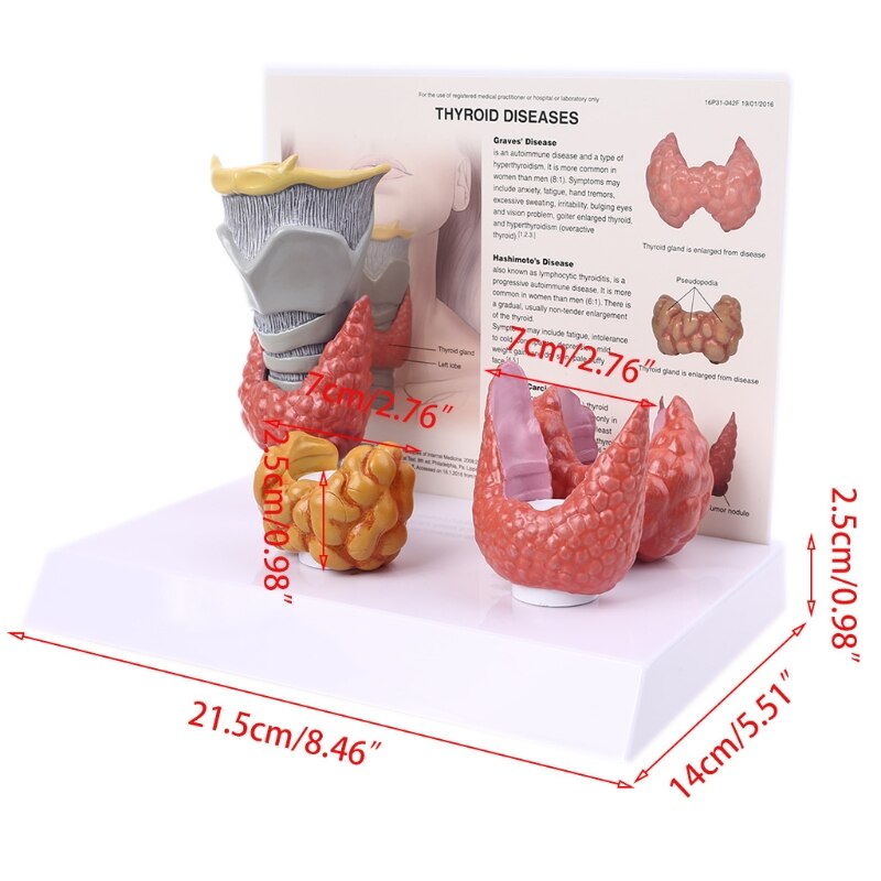 Ludzki anatomiczny Model tarczycy patologia anatomia układ trawienny badanie narzędzie robić nauczania