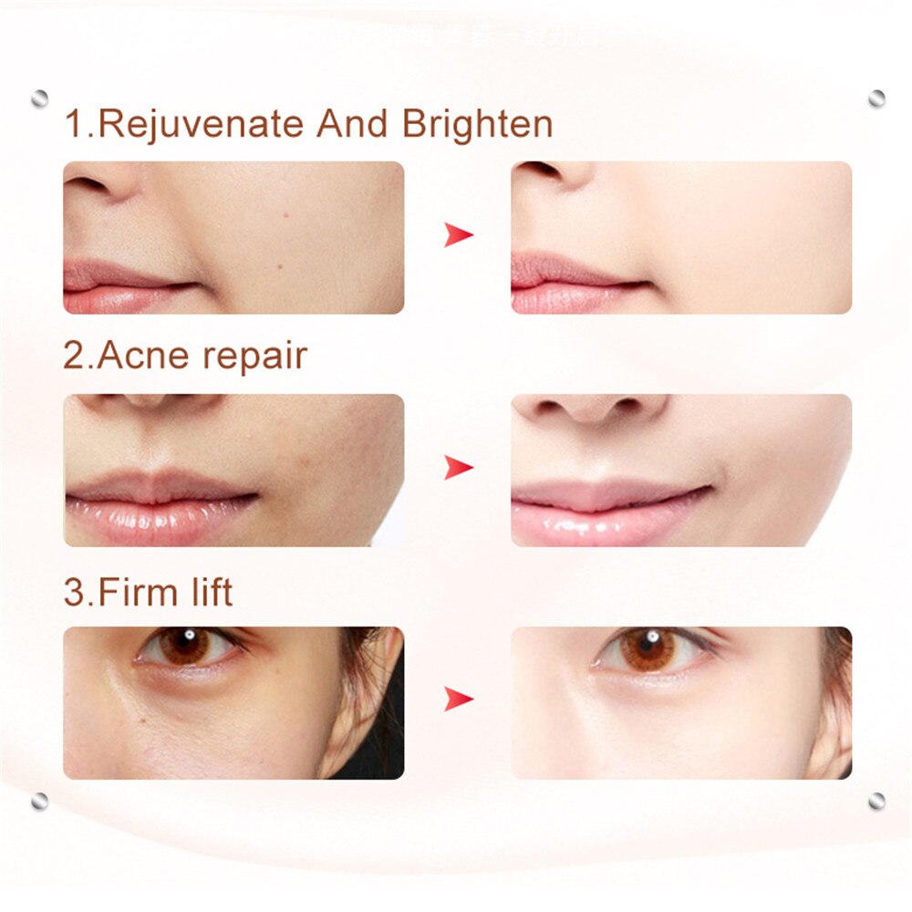 Led-fotoni kasvojen mesoterapia elektroporaatio ems-laite kasvojenkohotus kiristys ryppyjen poisto värähtelyhierontalaite