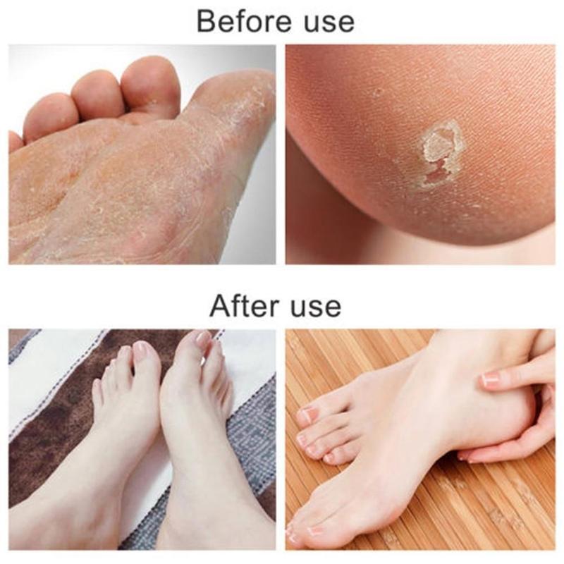 Papel de lija cepillo de pie duro muerto piel áspera removedor de callos pies exfoliar archivo herramientas para pies papel de lija cuidado Pedicur Ras F8M5