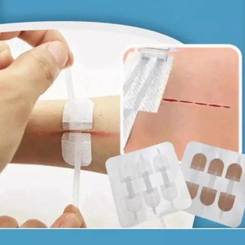 3 Stks/zak Fda Gecertificeerd Rits Pleister Outdoor Geen-Naaien Quick Wond Dressing Hechtdraad Tape Bandage Hechtdraad-gratis Zip Band-Aids Tool