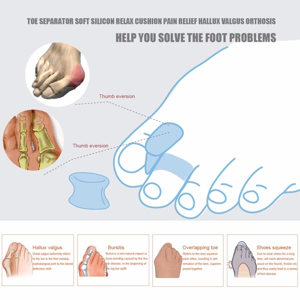 1 paar teenspreiders zachte siliconen voetverzorging beugels ondersteuningen hulpmiddelen relax kussen pijnverlichting hallux valgus orthese
