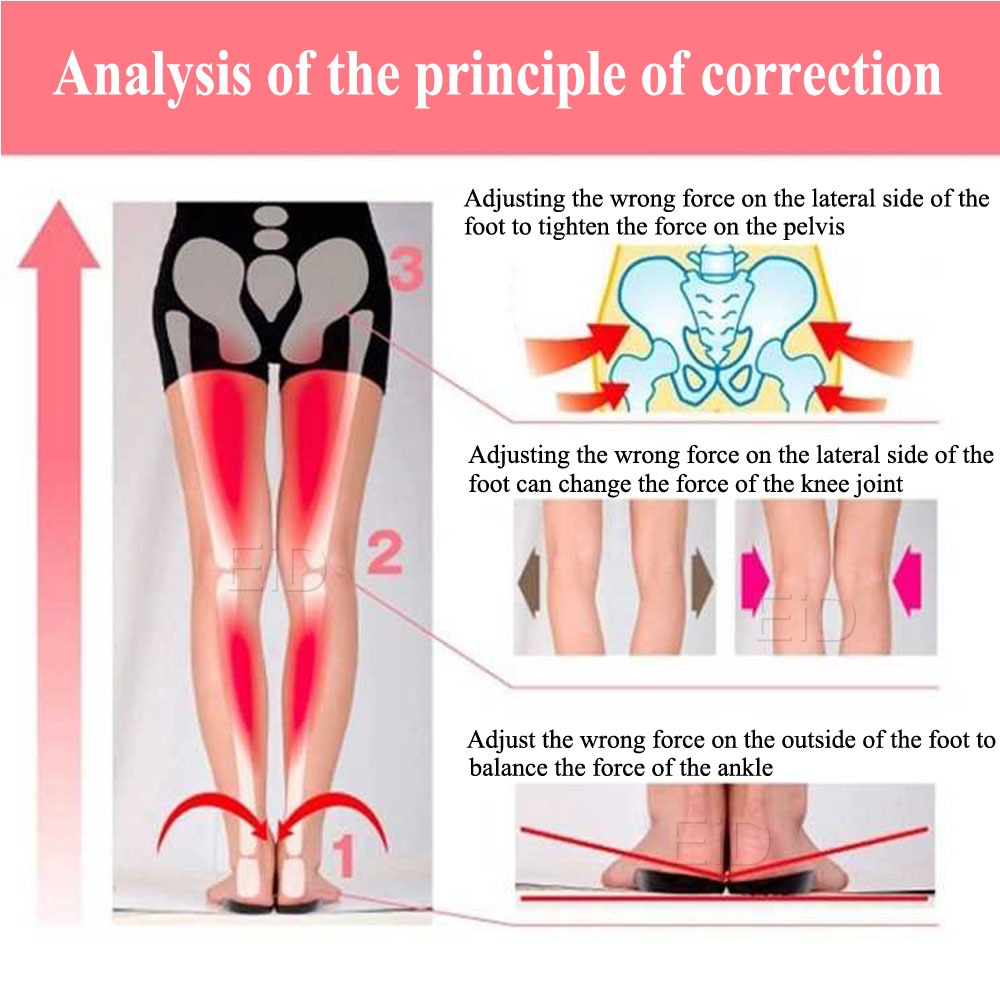 OX Leg Orthotics Cubitus Varus half flat foot Insole Orthopedic Insoles for Shoes insert Arch Support pad for plantar fasciitis
