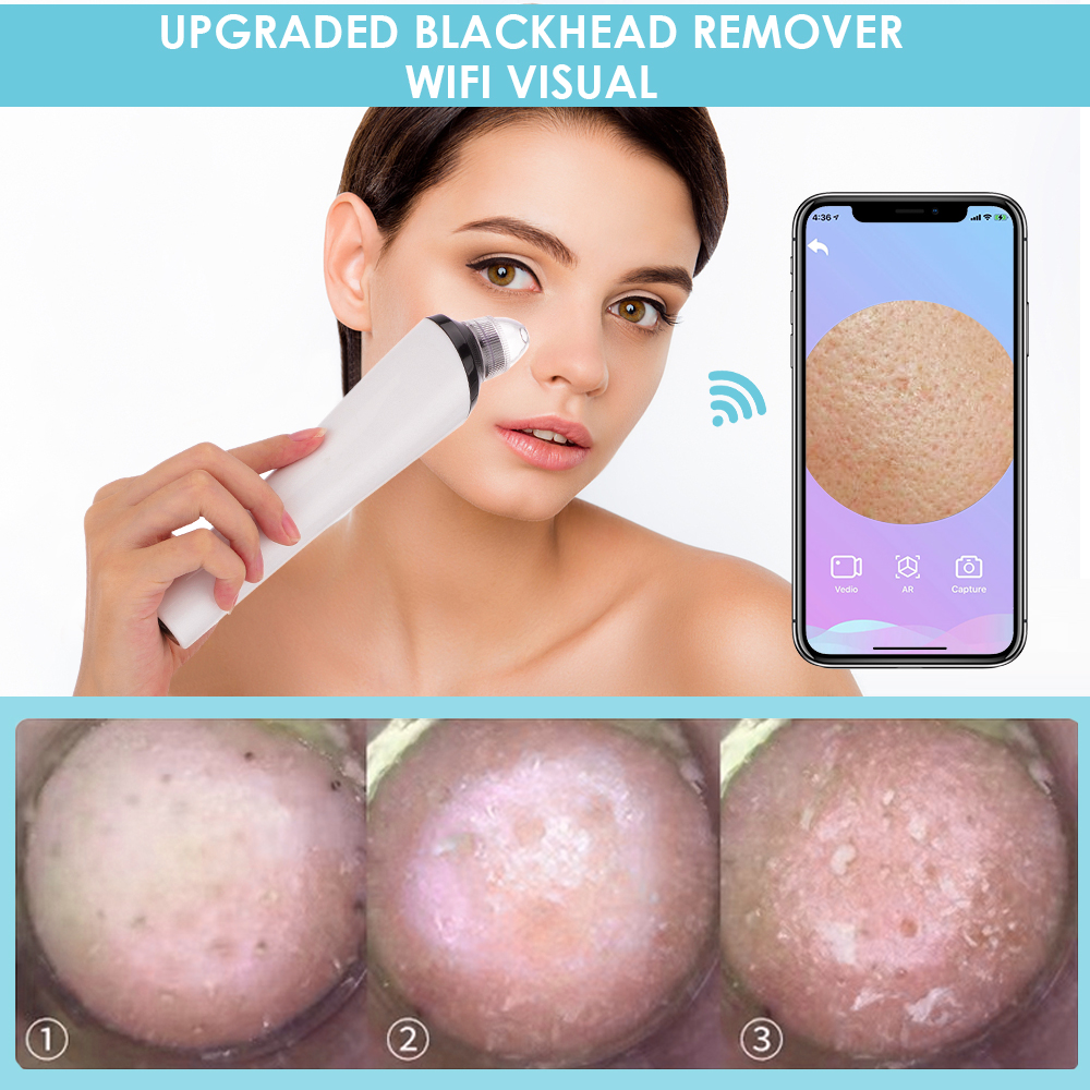 WiFi Camera Visual Face Blackhead Remover Vacuum Suction Pore Cleaner Face Deep Nose Cleasning Pimple Removal With 3 heads Tool