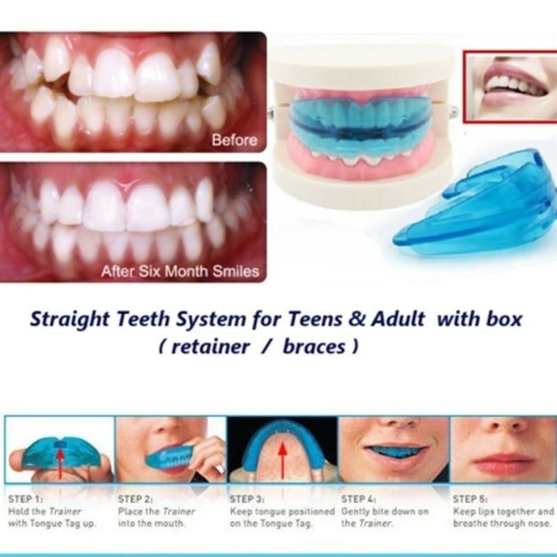 Lige tænder system bid ret tand tænder tandregulering holderen klar