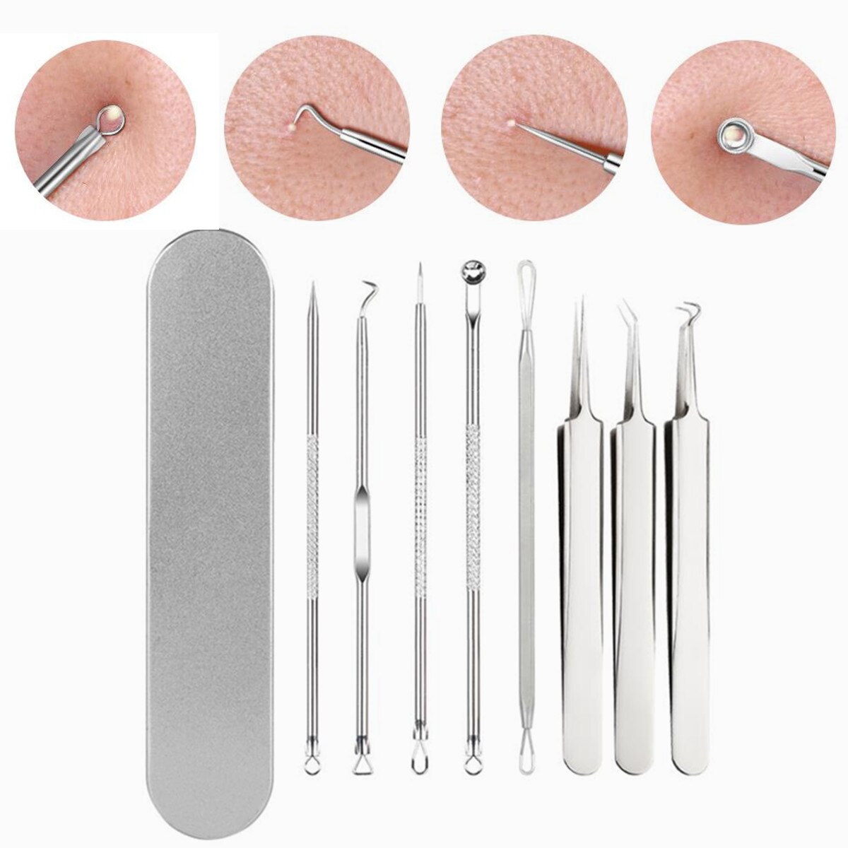 8X Blackhead Whitehead Pimple Spot Comedone Acne Extractor Remover Blemish Tool