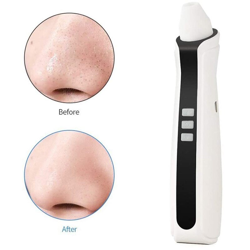 Nettoyeur de points noirs visuel USB Rechargeable Pores du visage nettoyeur de tête noire aspirateur 500X WiFi Microscope caméra 3 tête d'aspiration