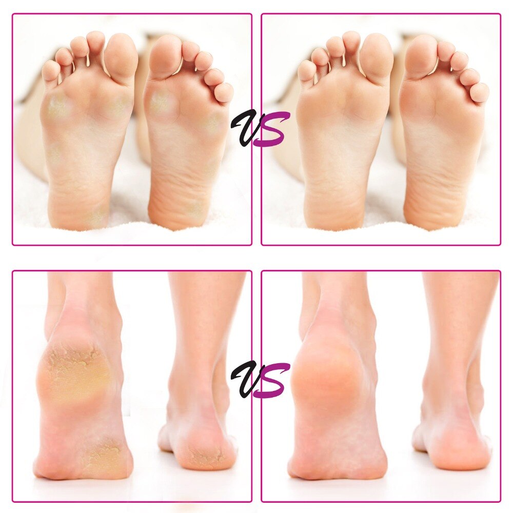 Narzędzia elektryczne pedicure urządzenie robić pielęgnacji stóp suchy martwy, twardy ścinacz robić usuwania zrogowaceń naskórka z wymiennym papier ścierny elektryczny pilnik robić stóp