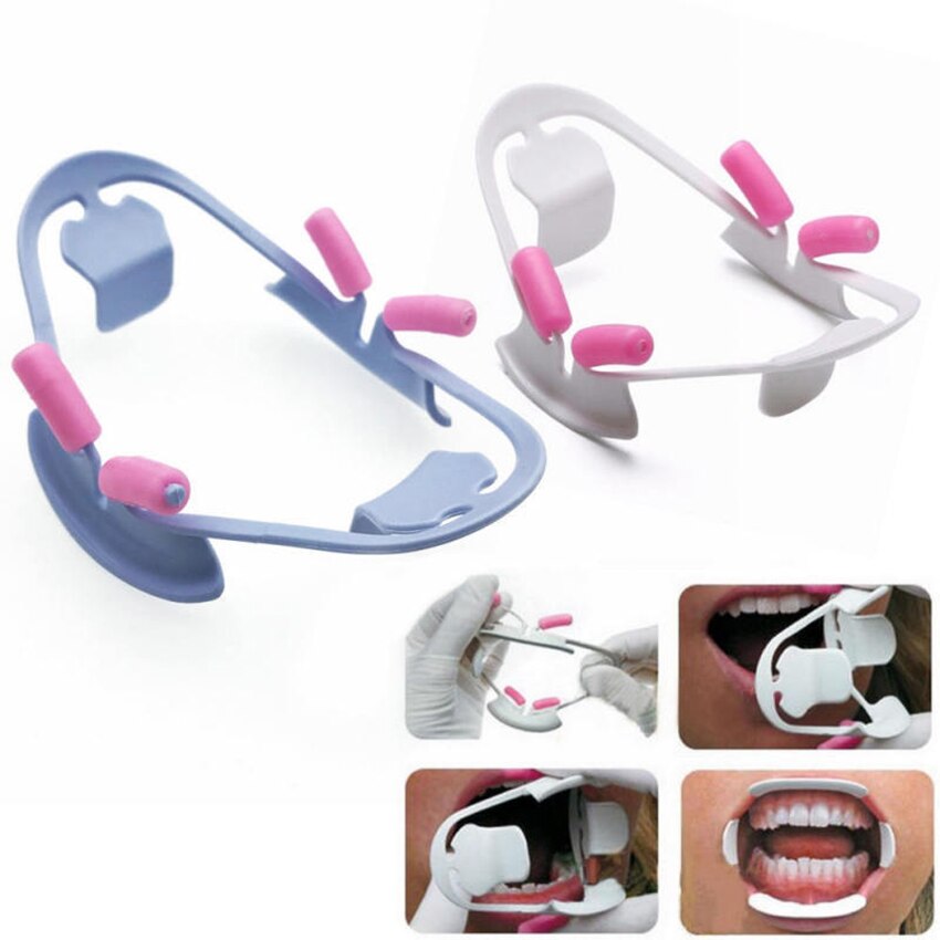 Orale Dental Mond Opener Intraoral Cheek Lip Retractor Prop Orthodontische Volwassen Lip Orale Schoon Opener Tandarts Materialen Mond Open