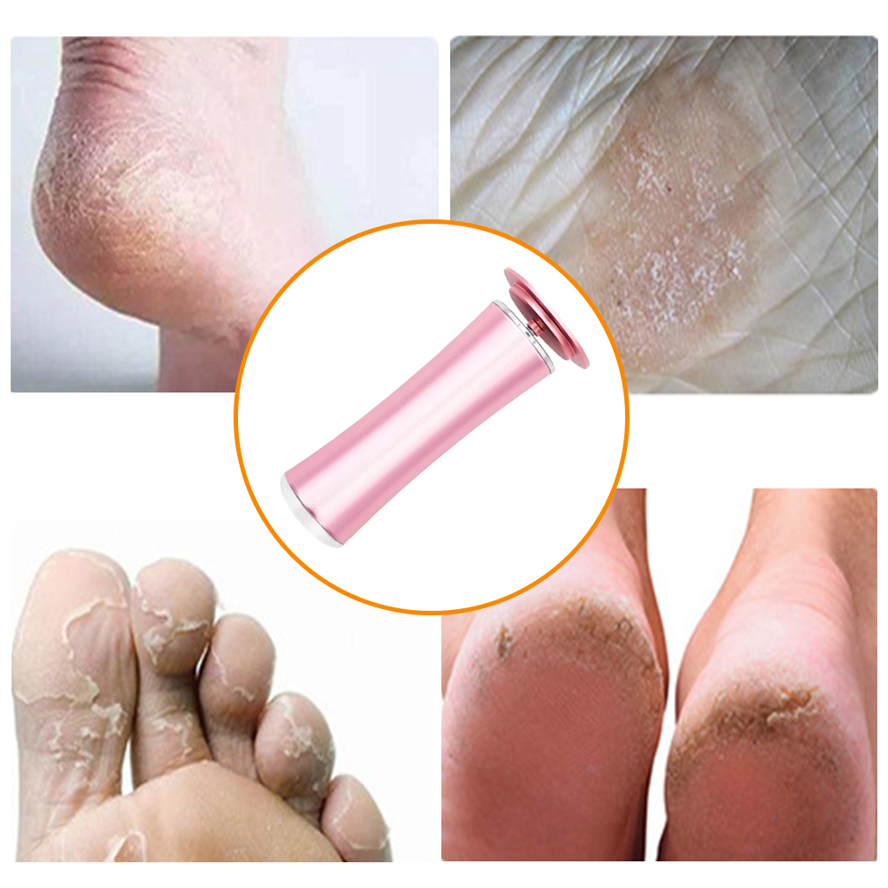 Ponceuse électrique multifonction pour les pieds, élimine les callosités, la peau morte, la dureté, les talons, pour pédicure, Instoc