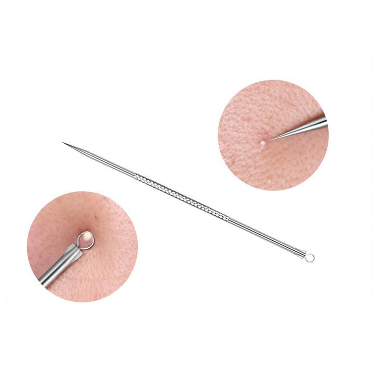 8X Blackhead Whitehead Pimple Spot Comedone Acne Extractor Remover Blemish Tool