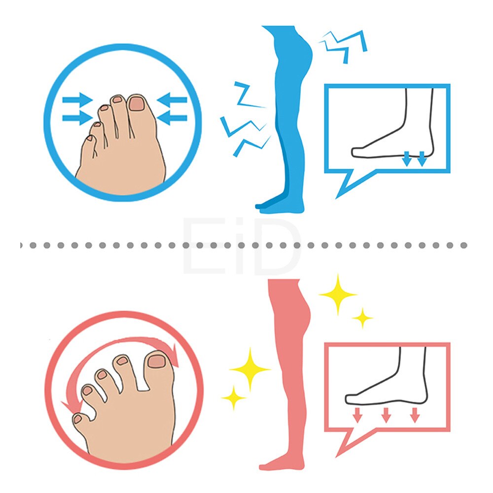 Indlægssåler hallux valgus orthotics knystpuder til separate alle tå store ben ortopædiske fodhammer korrektor separator indlæg pude