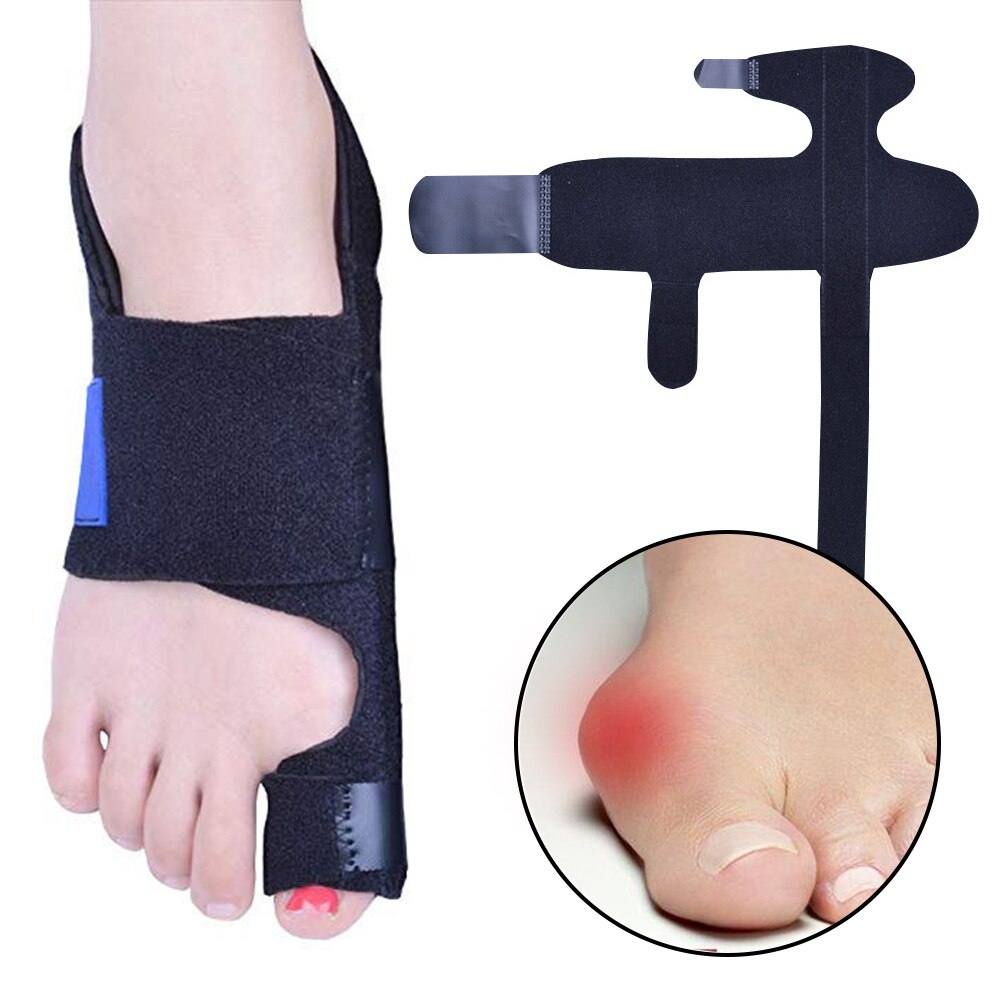 1 Paar Grote Teen Hallux Valgus Corrector Orthotics Voetverzorging Bone Duim Richter Correctie Pedicure Bunion Stijltang