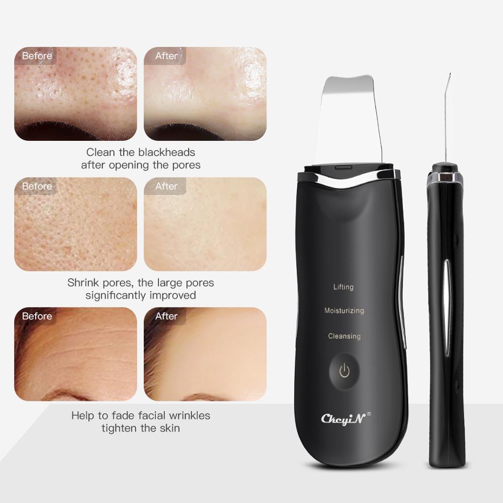CkeyiN piel ultrasónica del depurador espinilla limpiador Facial espátula piel Peeling exfoliante + Nano pulverizador + Ance removedor de 48
