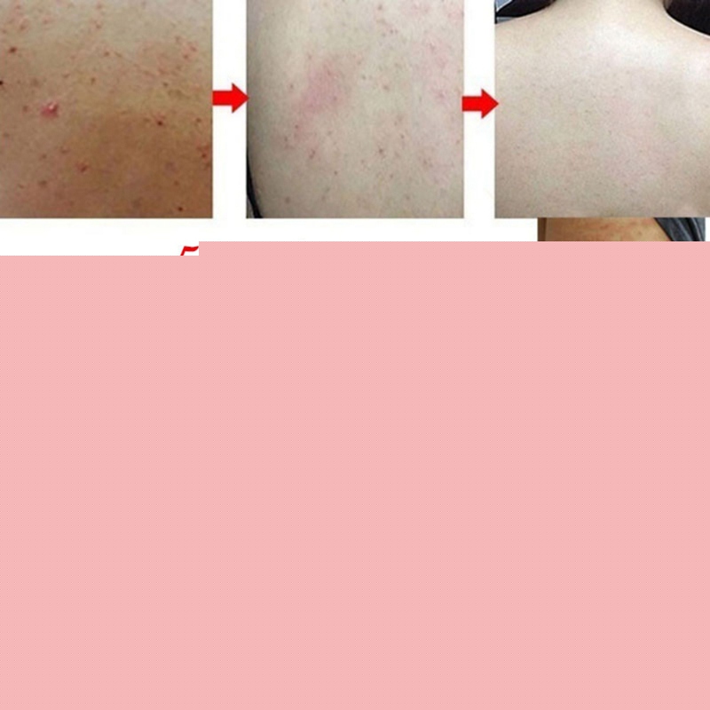Savon au soufre Anti-acariens Anti-acné savon huile nettoyage Pores corps nettoyage savon coffret contrôle savon Base nettoyage de la peau fournitures