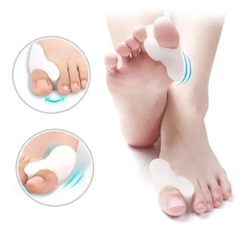 2 Stuks Siliconen Gel Duim Corrector Bunion Voet Teen Hallux Valgus Protector Separator Vinger Stijltang Richter Voetverzorging Tool