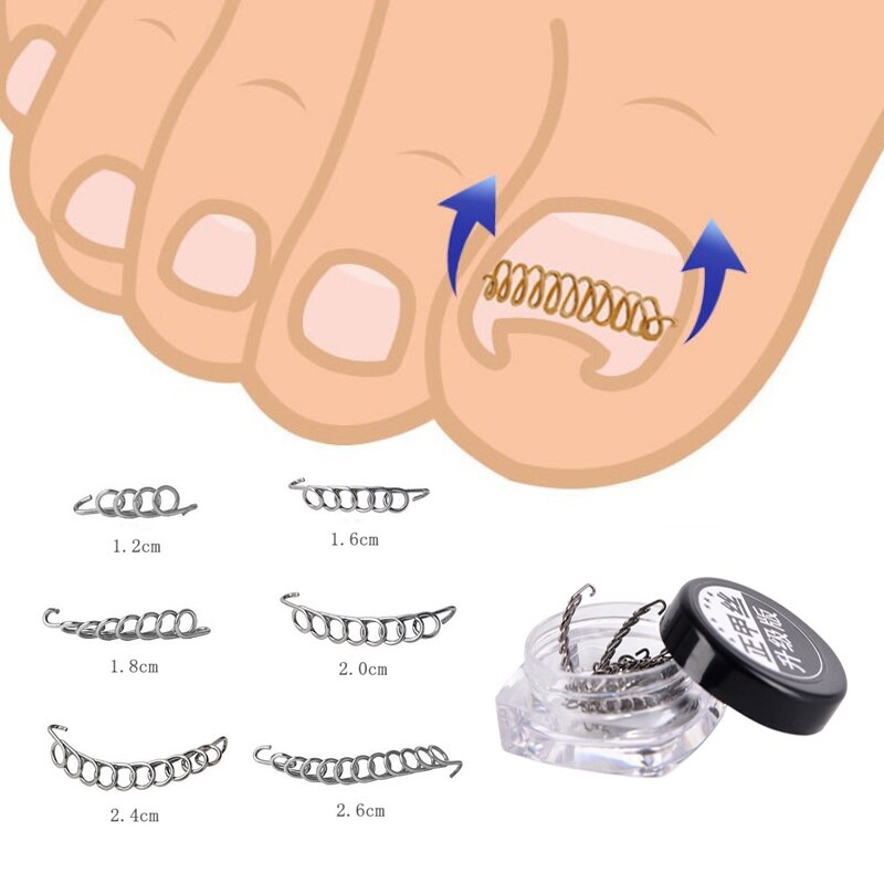 2 stücke Eingewachsene Finger Kappe Nagel Korrektur Zangen Nagel Clipper Schneider Toten Haut Schmutz Entferner Paronychie Podologie Pediküre Werkzeuge: 1 box