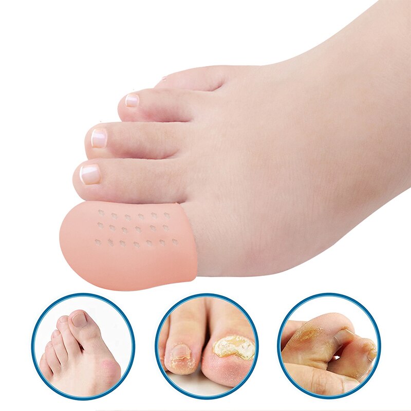 Pexmen 2 Teile/para Gel Zehe Separator Ballen Knochen Ektropium Erzähler Zehen Außen Gerät Fuß Pflege Werkzeuge Hallux Valgus Korrektor: Gold