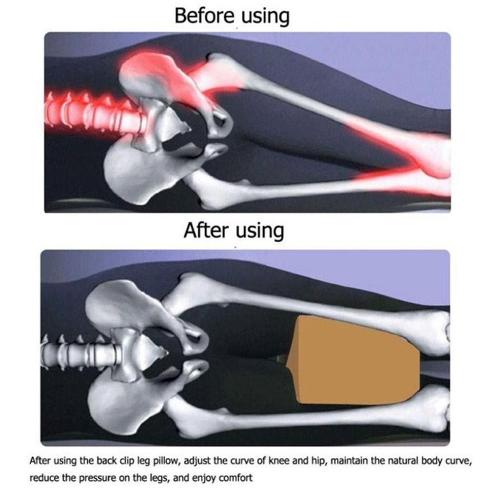 Vlinder Vorm Kussen Voor Slapen Traagschuim Been Klepstandsteller Kussens Knie Ondersteuning Kussen Tussen De Benen Heup Pijn Ischias