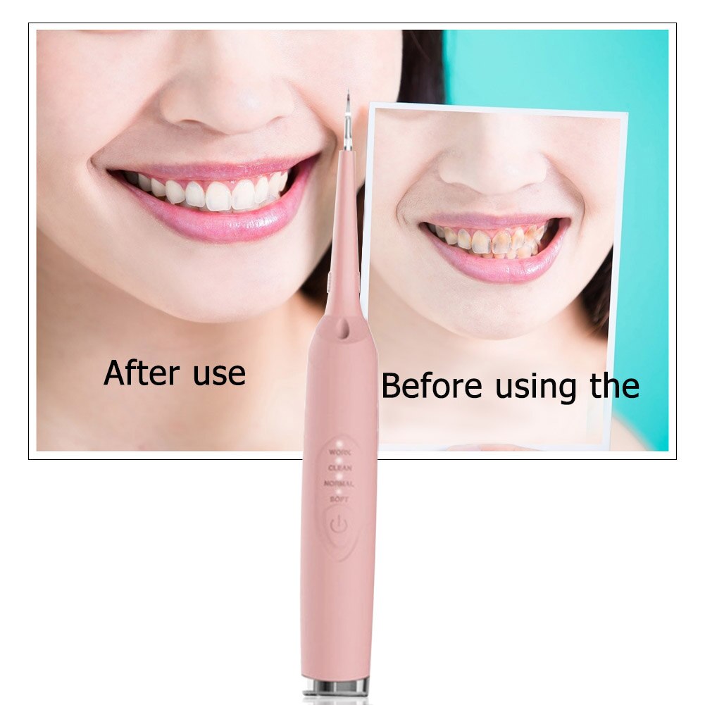 Portable Electric Ultrasonic Sonic Dental Scaler Tooth Calculus Remover Cleaner Tool Teeth Whitening Oral Hygiene Equipment
