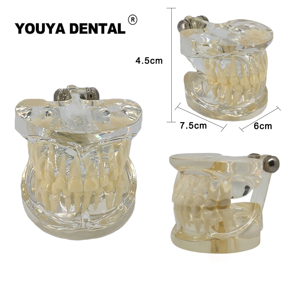 Dental Teaching Model Children Deciduous Tooth Permanent Teeth Alternating Study Pediatric Dental Pathology Preventive Model