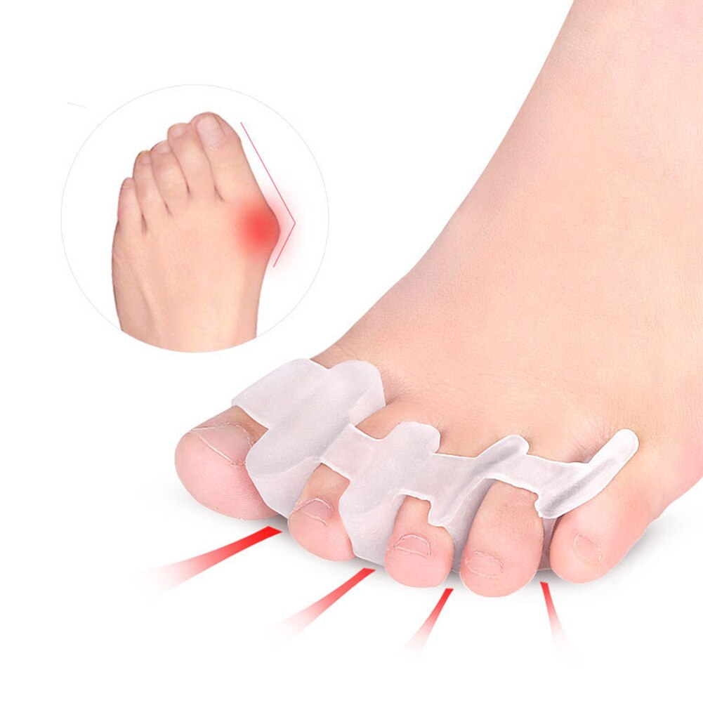 1 pari varpaat hallux valgus corrector separator suoristus jalkojenhoitolaite silikoni bunion suojelija sormet