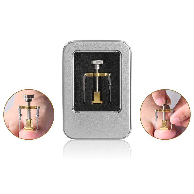 Ingrown Toenails Pedicure Foot Nail Care Tools File for Feet Orthotic Acronyx Ingrowing Nail Onyxis Bunion Corrector for Toes