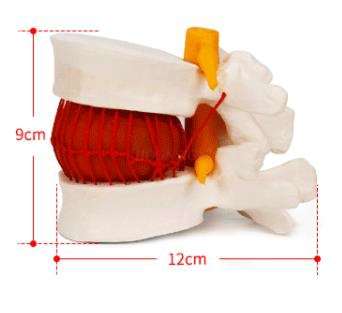 Menschlichen lumbalen bandscheibe Demonstration modell skelett modell Menschlichen lenden wirbelsäule wirbelsäule gemeinsam modell medizinische