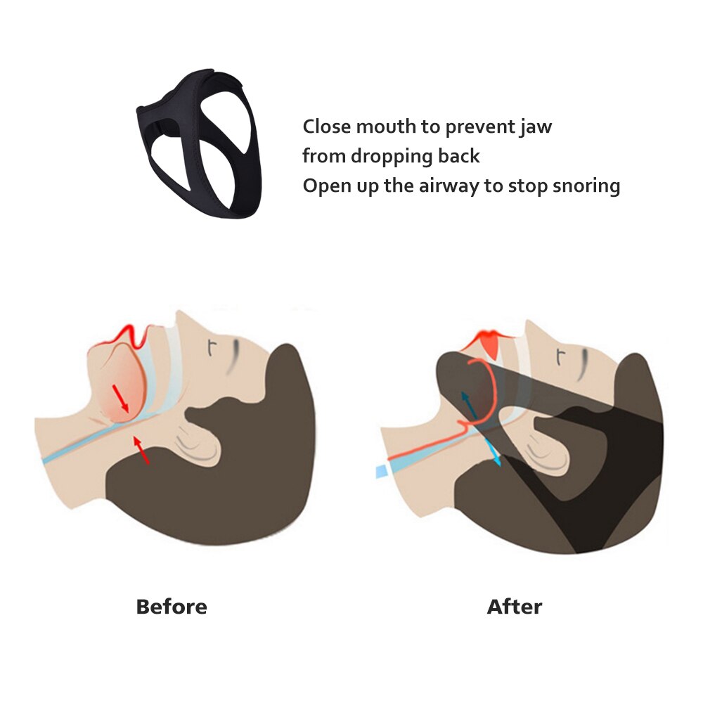 Sangle de menton Anti-ronflement, outil de Bandage pour aider à dormir la nuit, apnée du menton, directe
