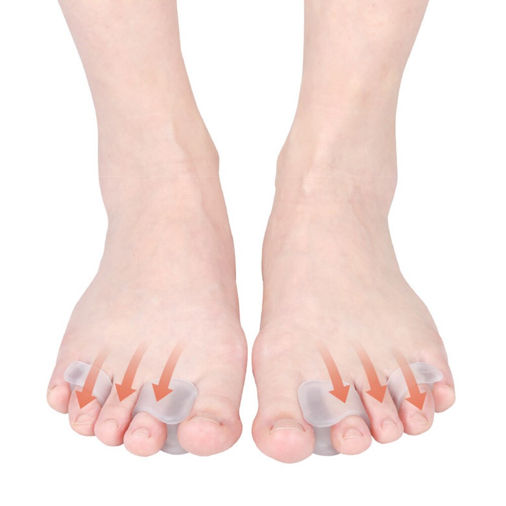 Klassieke Sebs Teen Separator Praktische Duurzaam Multi-Functionele Bunion Hallux Valgus Spalk Orthese Overlappende Protector