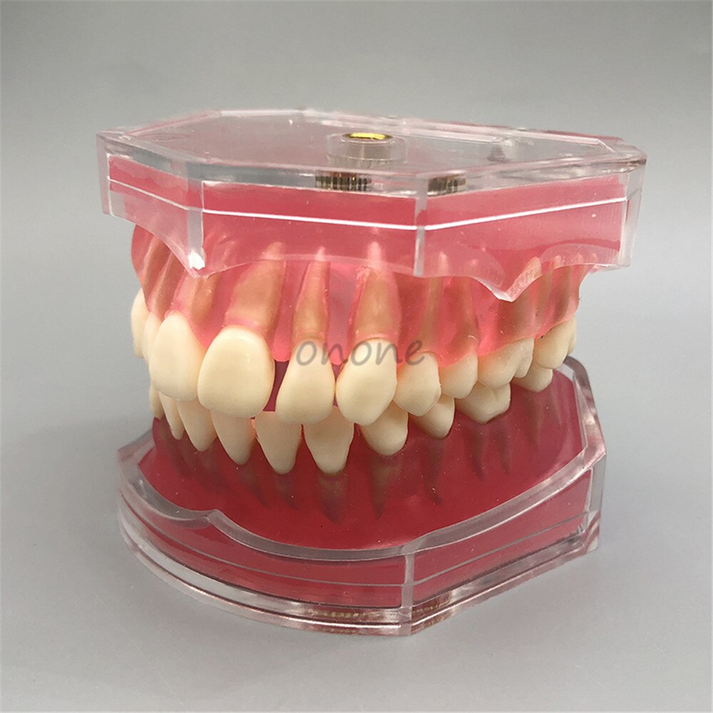 Dental Standard Model with Removable Teeth Dental Study Teach Teeth Model
