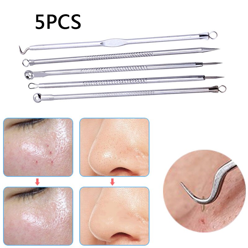 Set van 5 premium mee-eters, acne, comedonen, puistjes, vlekverwijderaars, mee-eters, puistjes, naalden, huidverzorgingsset