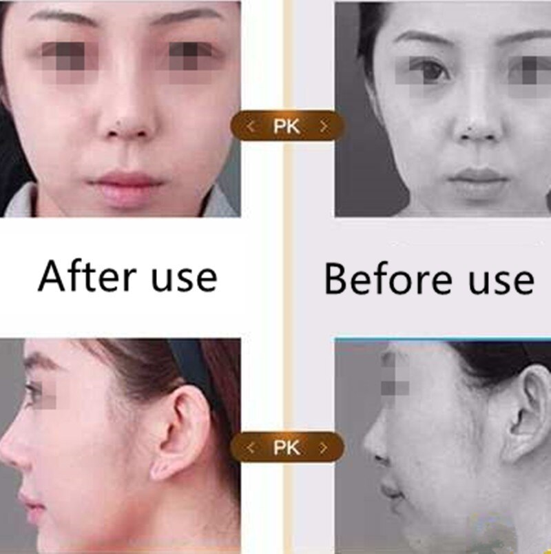 Shaping Lifting Nose Up Clip Beauty For Trouble Breathing Portable Nose Clips Beauty Tools