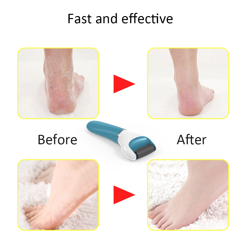 Abody électrique pied fichier pied soin outil pédicure Machine peler peau rouleau callosités dissolvant fichier pour homme pied talon