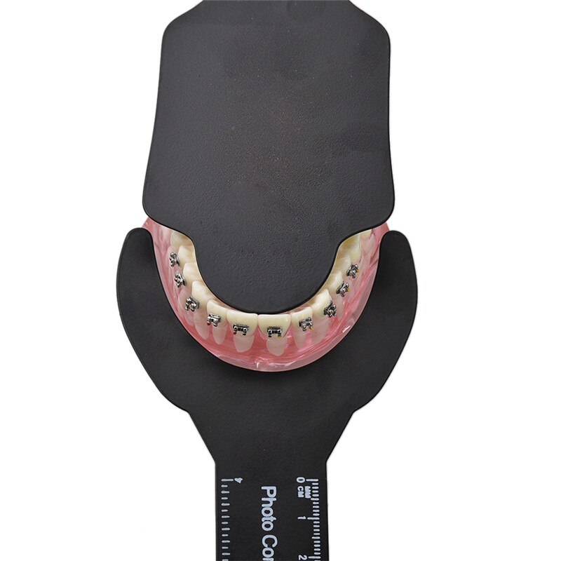 6 Pcs Dental Orthodontische Zwarte Achtergrond Board Foto Afbeelding Contrast Board Oral Cheek Plaat Met Schaal Mark Autoclaveerbaar Gereedschap
