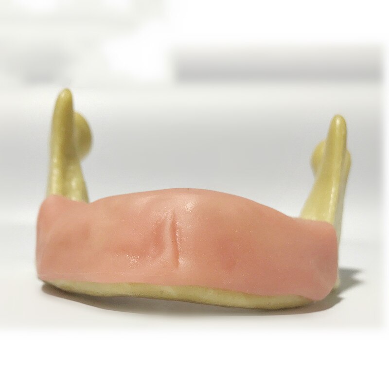 Práctica de sutura gingival suave de 7 tipos, formación Dental, implante de simulación de práctica de implante, modelo de dientes faltantes osteoaxilares: green