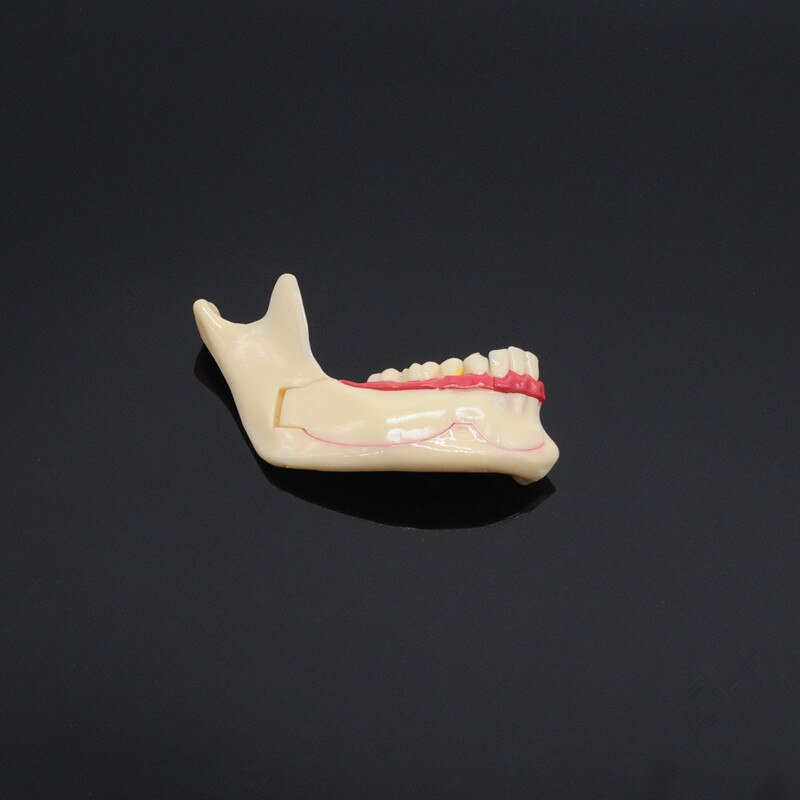 Tandpleje undervisning uddannelse model dental kommunikation model mandibular model